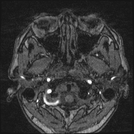 Click on the Serie image to view the images of VILLANUEVA, WILLIAM A.